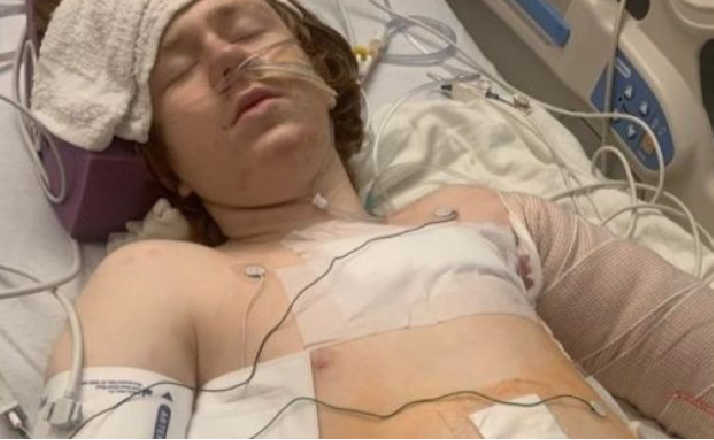 Police Shoot 13 Year Old Boy with Autism Leaving Him in Serious Condition