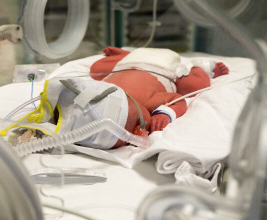 NICU baby