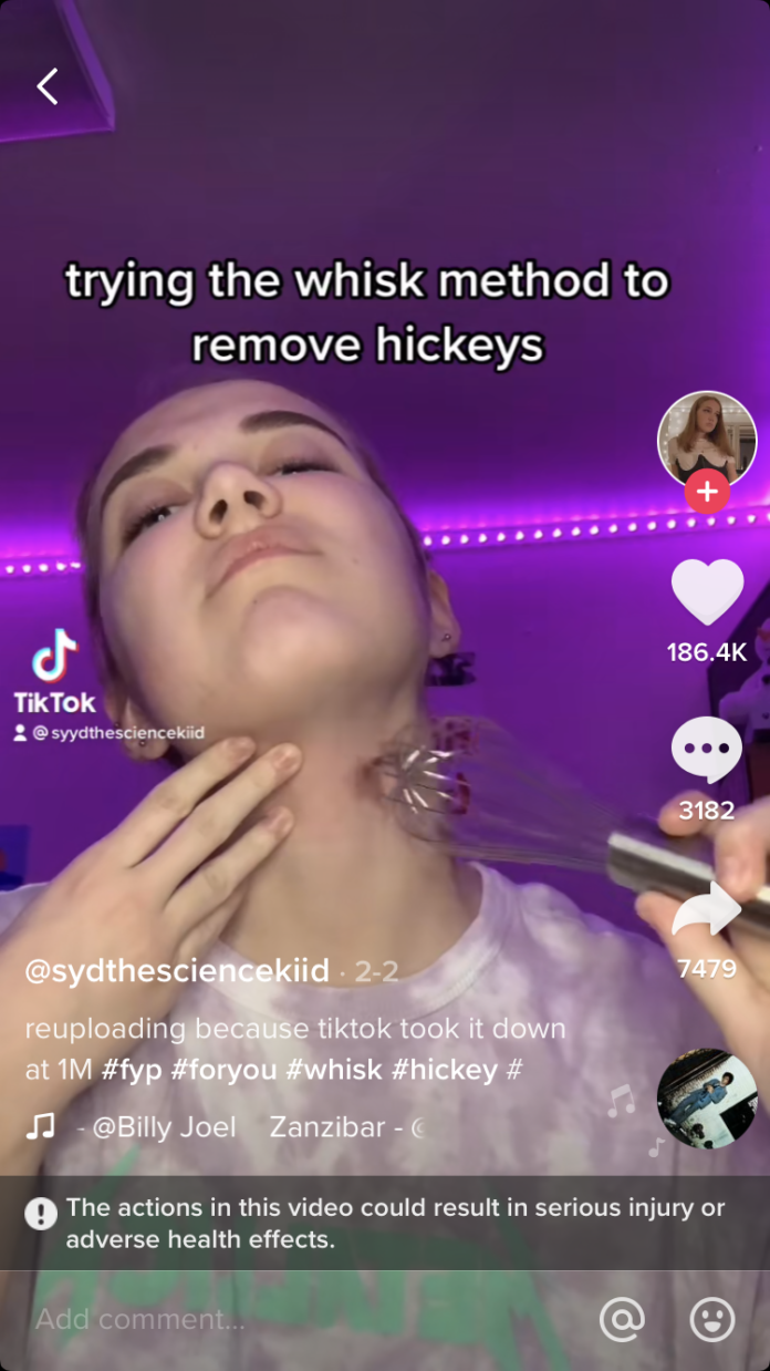 TikTok Teens are Using Whisks To Get Rid Of Hickeys In One Of The