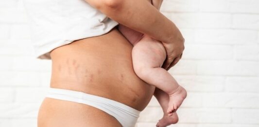body changes after pregnancy