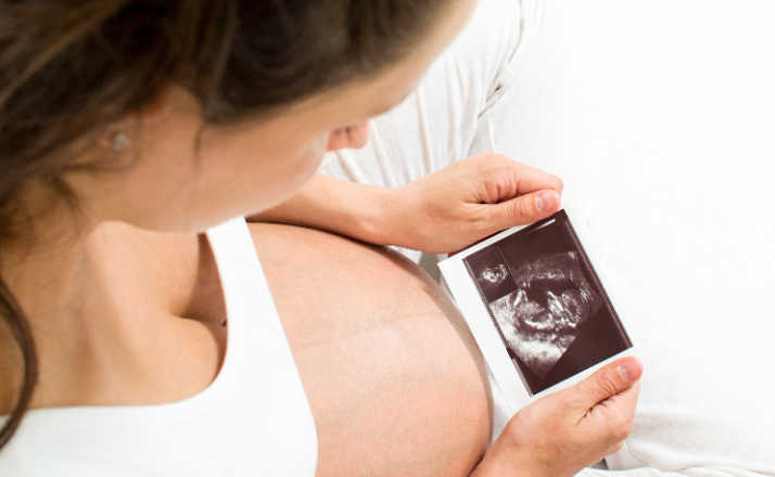 young pregnant woman looking at baby scan