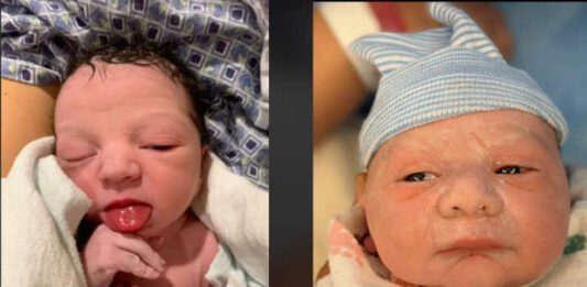 two weird newborn baby photos