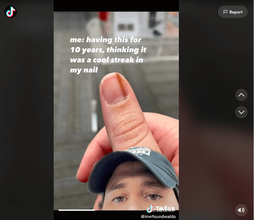 Screenshot of TikTok video showing a thumbnail with a brown streak