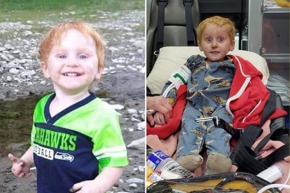 side-by-side photo of rescued montana boy