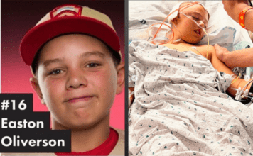 Easton Oliverson suffered skull fracture